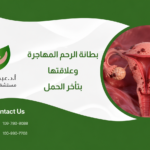 بطانة الرحم المهاجرة وعلاقتها بتأخر الحمل